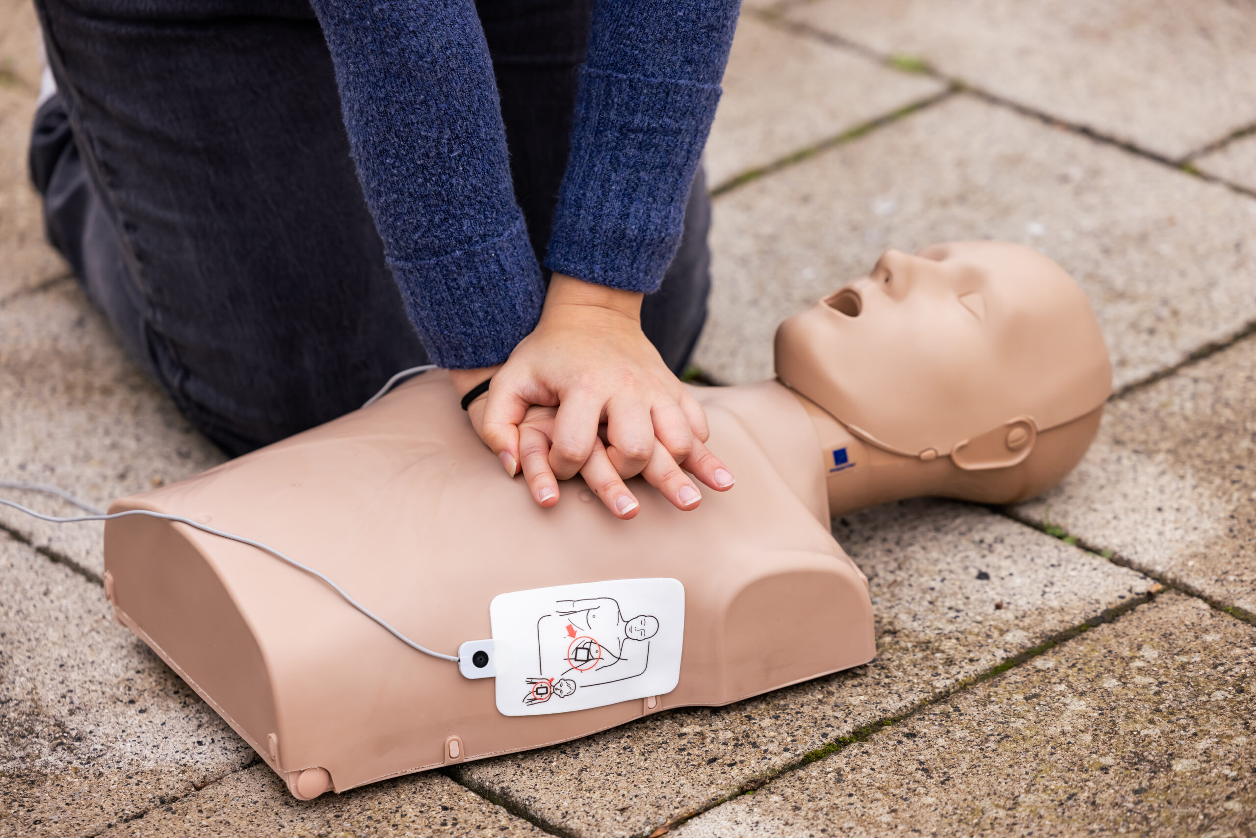 Hand placement for CPR, showing interlocked fingers on centre of chest